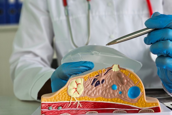 What You Should Know Before Breast Augmentation Surgery