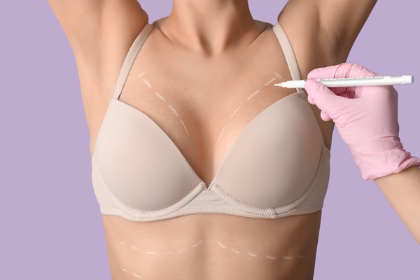 How Long Will Breast Lift Surgery Results Last?