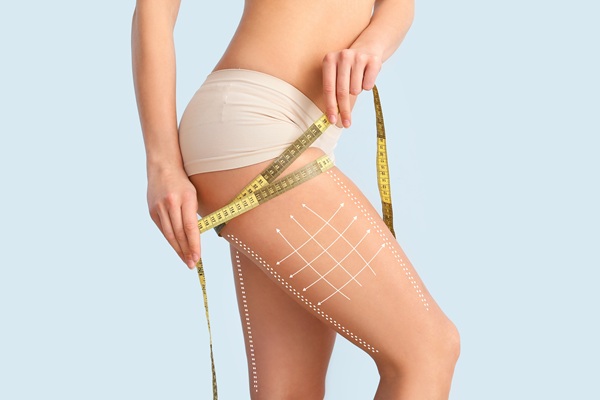What Makes A Good Candidate For A Thigh Lift?